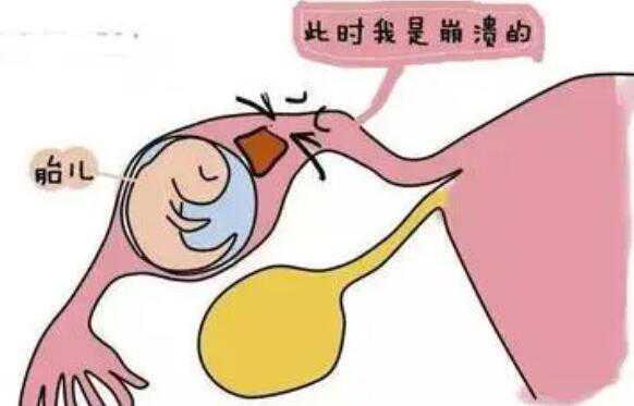 上海代怀哪里最安全 上海第一妇婴试管哪个医生好 ‘双顶径2.4头围9.1腹围8.1股